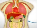 Organ Kupandikiza 2 kucheza online